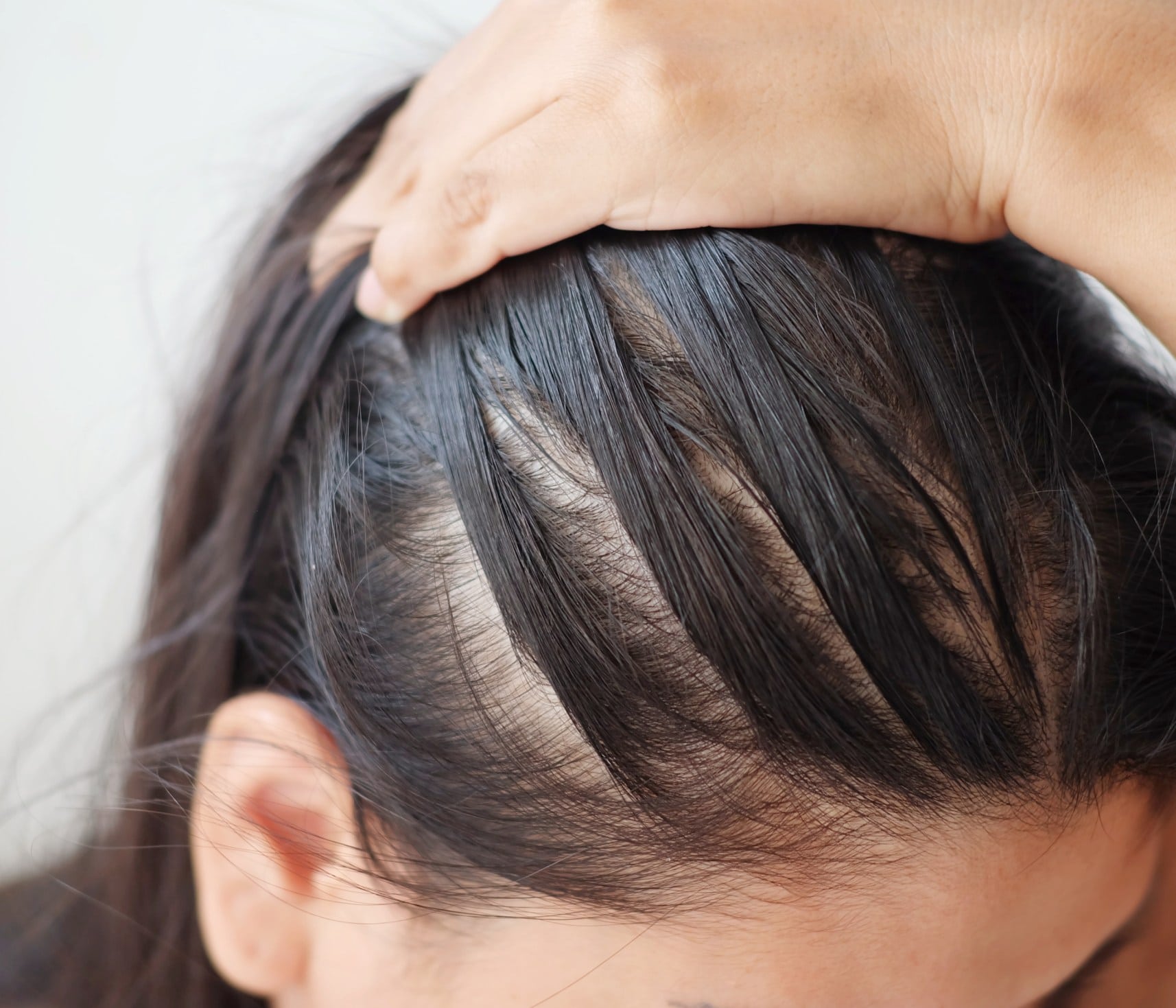 Injections de PRP cheveux : le traitement | Genève | Face Clinic